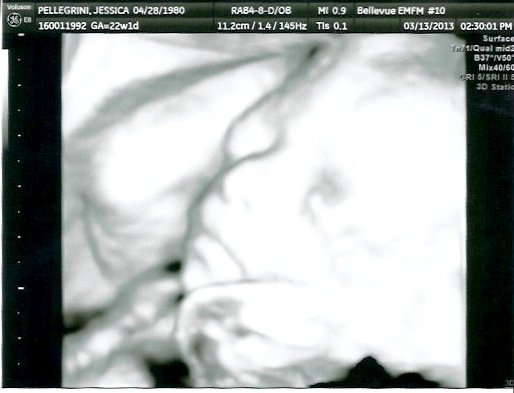 Baby E Ultrasound